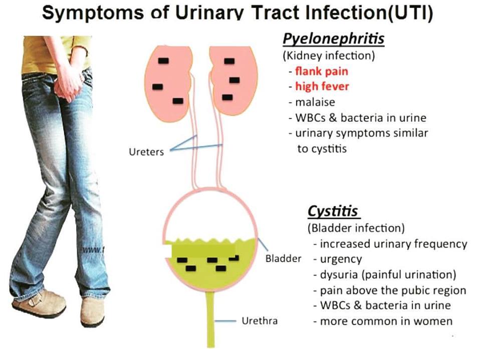 infezioni urinarie