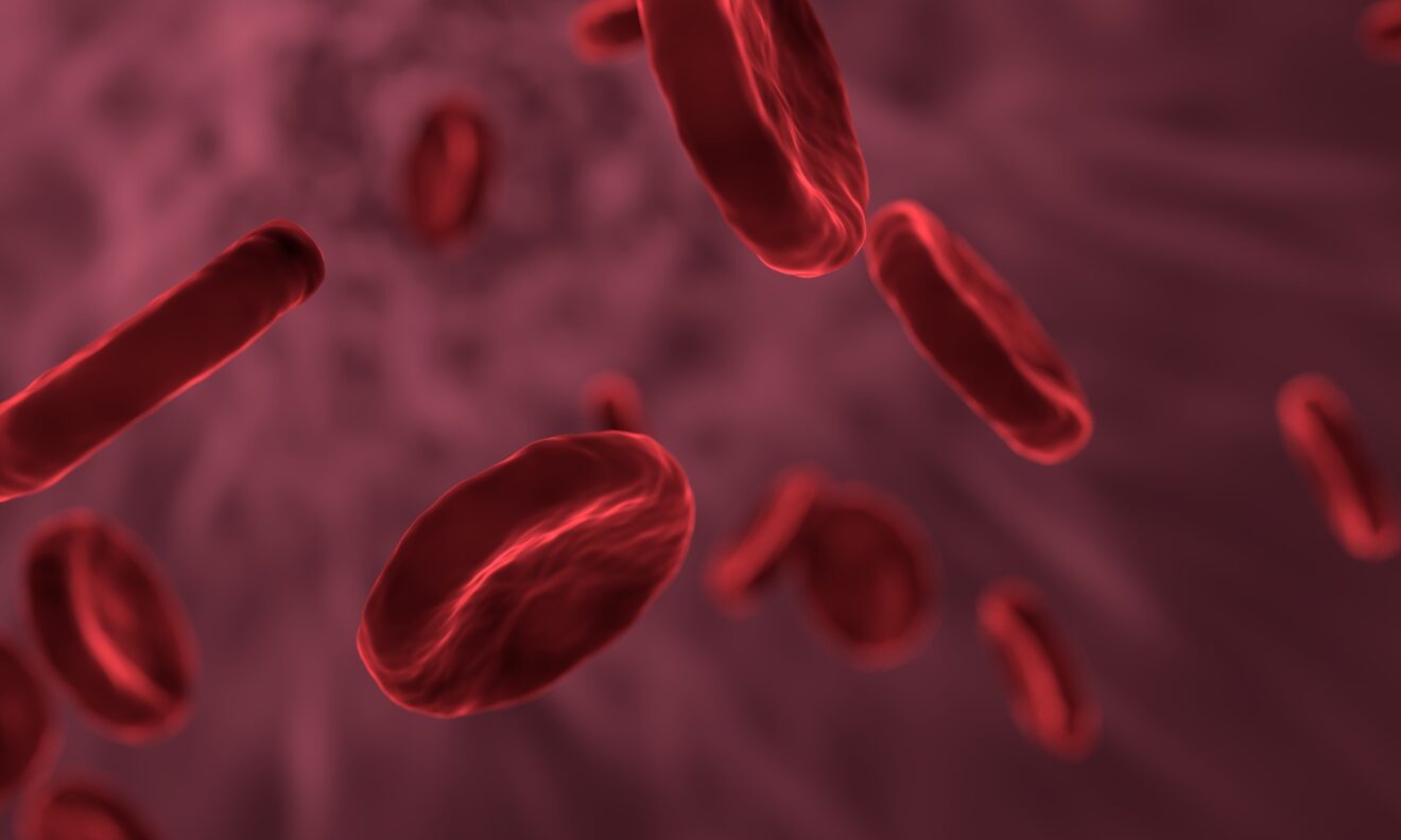 anemia mediterranea