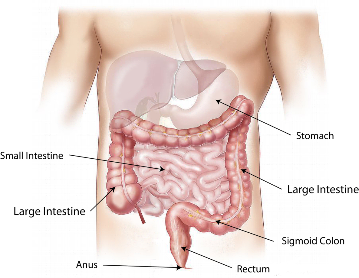 morbo di crohn