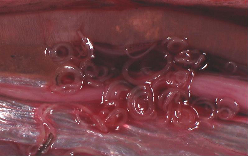 vermi intestinali