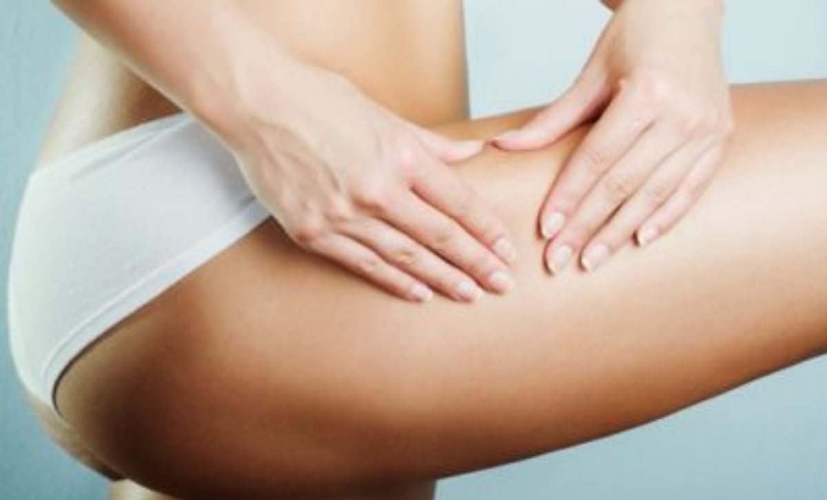 ritenzione idrica e cellulite