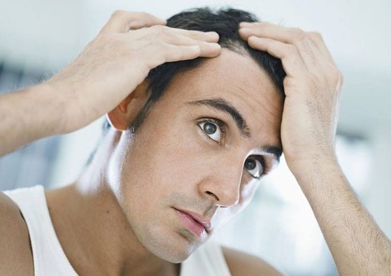 diradamento capelli 1200x846