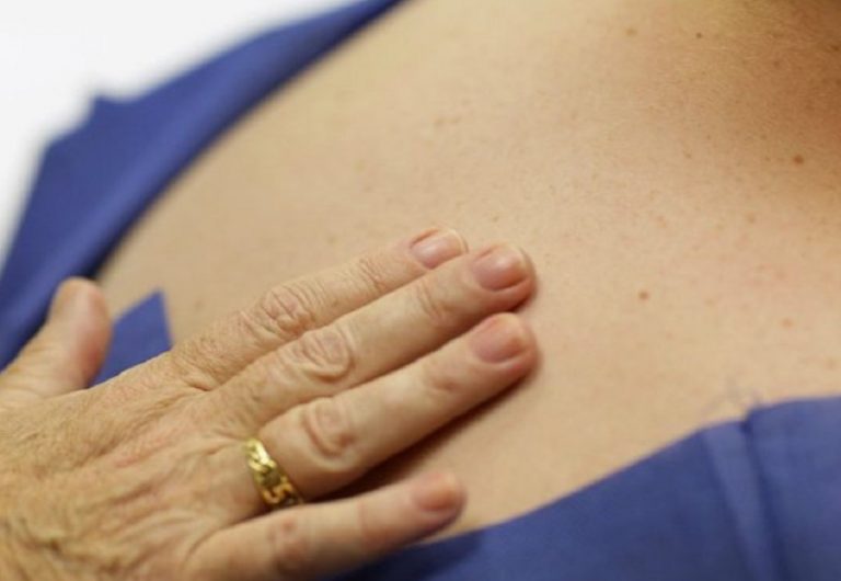 malattie della pelle