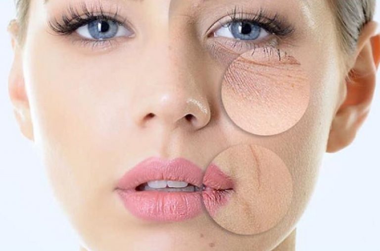 irritazione pelle del viso freddo