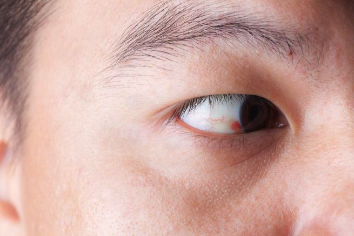 Le cause del prurito agli occhi