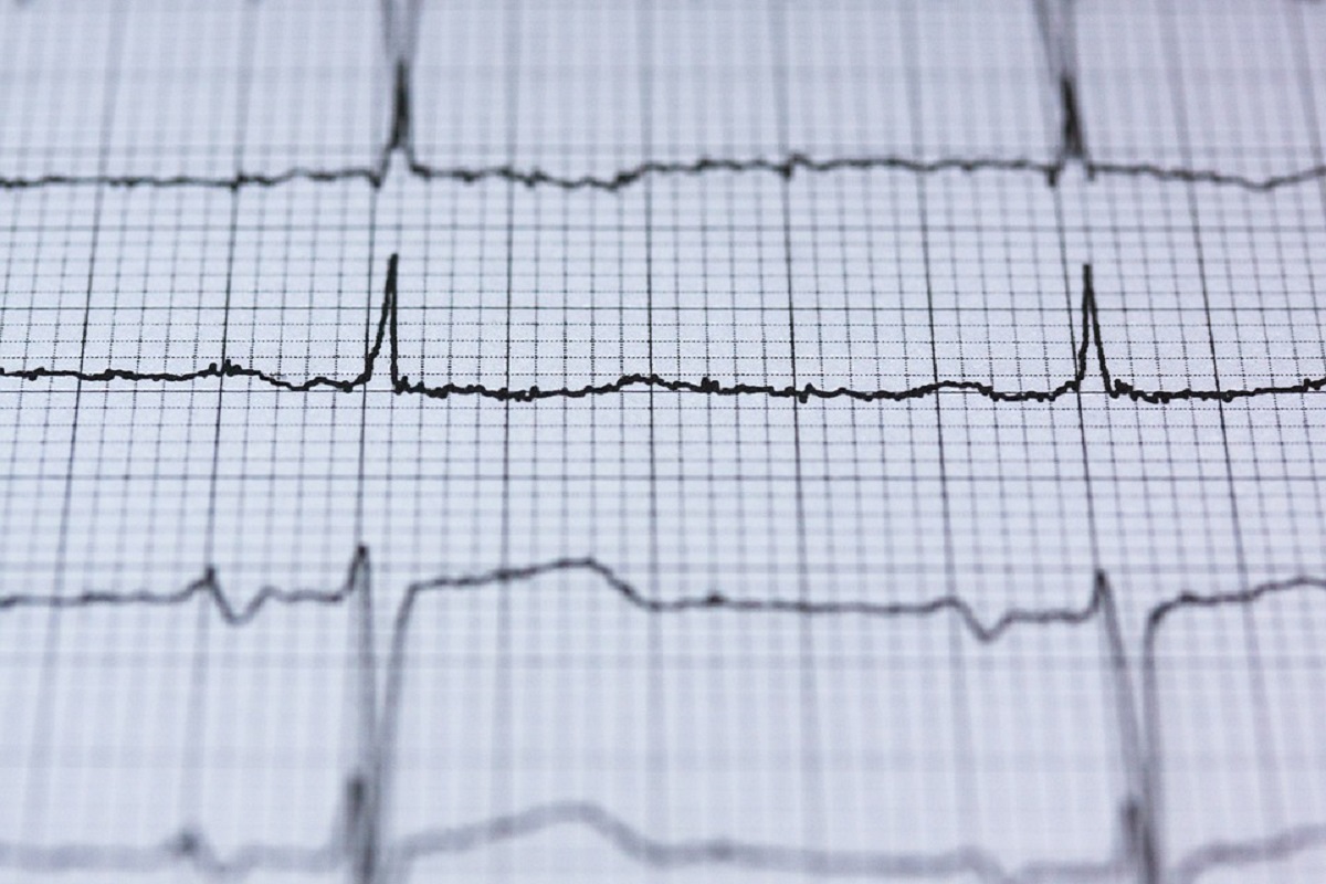 cosa sapere sulla frequenza cardiaca