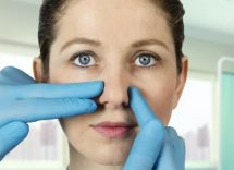 Come raddrizzare setto nasale deviato