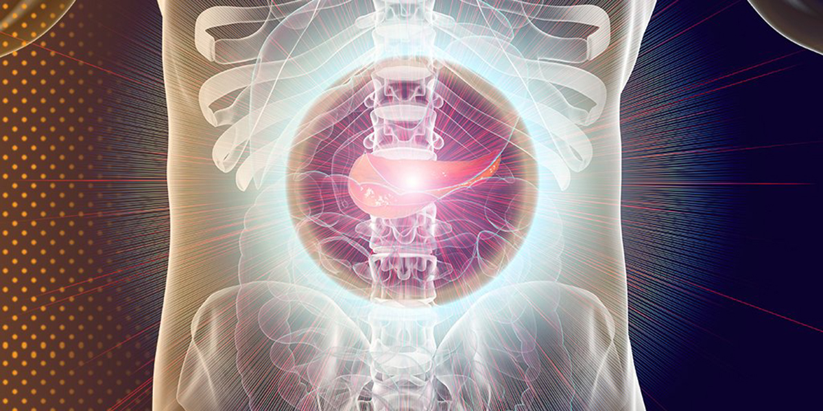 pancreatite cronica