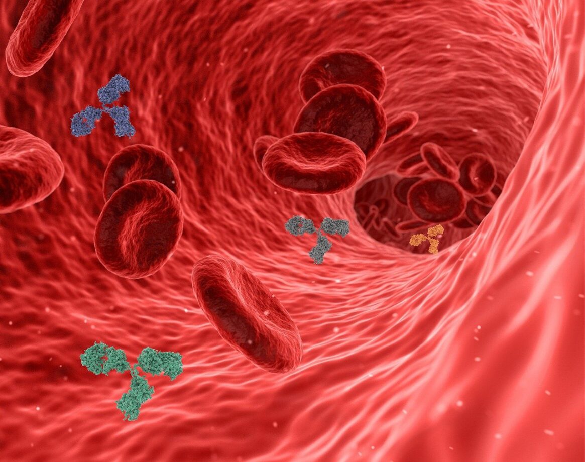 arterie ostruite alimenti