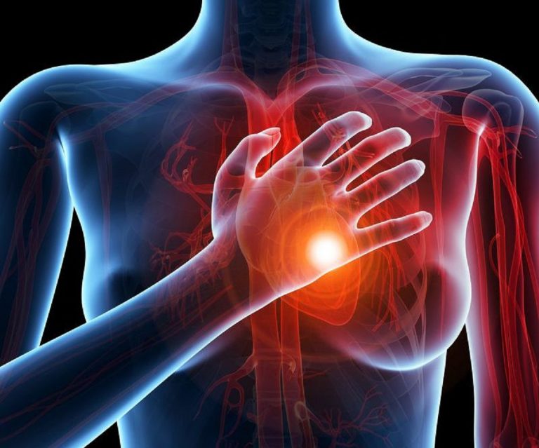 malattie cardiovascolari