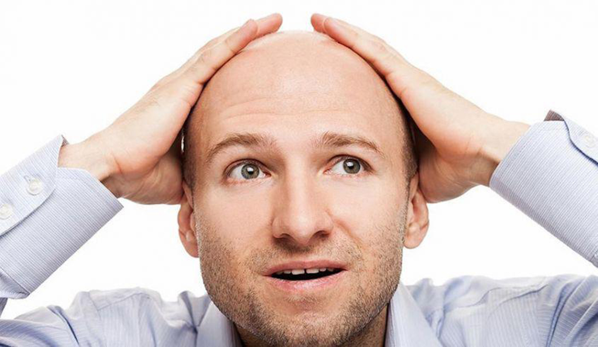 alopecia rimedi naturali