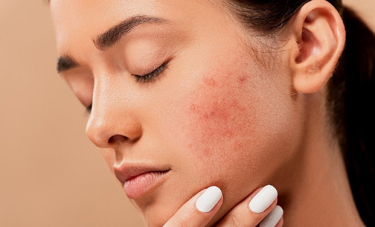 quali sono le cure naturali per la pelle?