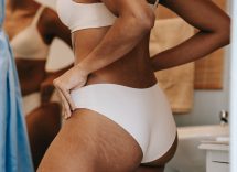 smagliature dieta stress