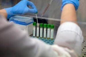 mers 9 casi con due morti in arabia saudita oms rischio moderato 2