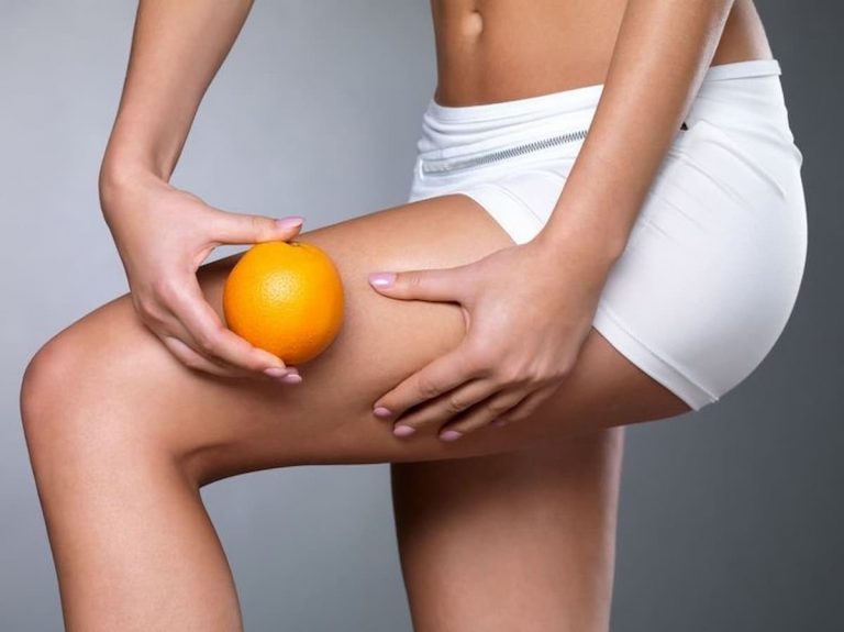 omega3 cellulite