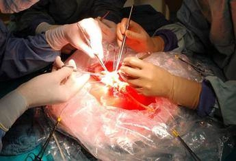 trapianti a padova impiantato il fegato di una 99enne la donatrice piu anziana di sempre 2
