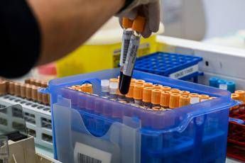 fegato un test per scoprire il rischio di gravi malattie entro 10 anni lo studio 2