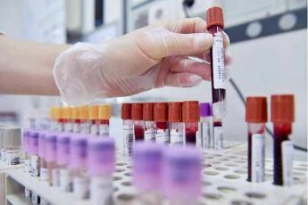 test del sangue puo escludere rischio demenza fino a 10 anni prima lo studio 2