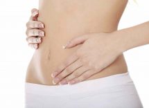 le tisane contro il gonfiore