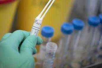 legionella in case popolari a milano un morto e diversi ricoverati 2