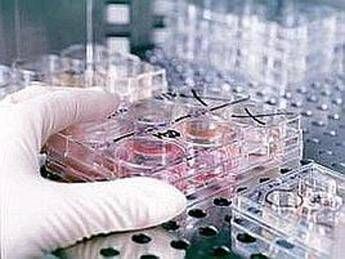 fecondazione non solo endometriosi il nuovo protocllo che combatte ladenomiosi 2