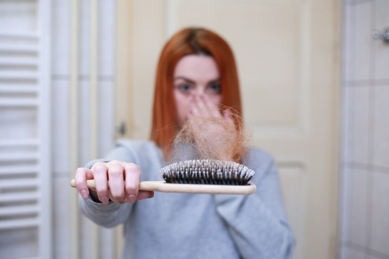 Caduta dei capelli a dicembre: come rimediare naturalmente