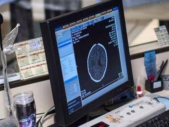 salute padovani sin longevita aumenta rischio alzheimer agire su prevenzione 2