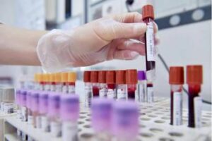 dal microbiota una speranza contro lepilessia resistente lo studio italiano 2