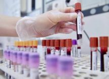 digiuno anti cancro dieta funziona ma insieme a farmaci 2