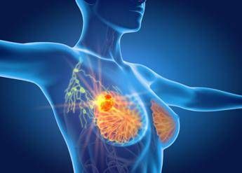 per cancro seno la cura che arriva dal gelo ieo verso un futuro no bisturi 2