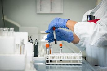 test del sangue prevede prognosi patologia renale lo studio 2
