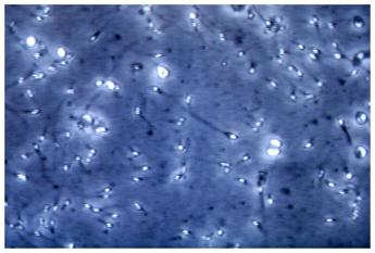 infertilita maschile dietro ce gene mancante spermatozoi sono sconnessi 2
