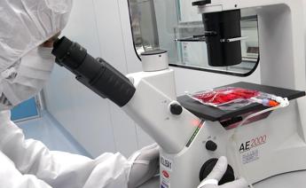 car t contro malattie autoimmuni bambino gesu tratta primi 3 pazienti 2
