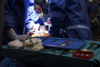 trapianti verso il cuore artificiale permanente nel 2025 primi impianti sperimentali 2
