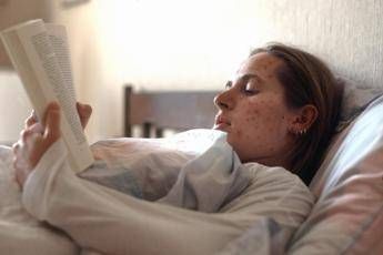morbillo record di casi in europa 127 350 nel 2024 mai cosi tanti in 25 anni 2