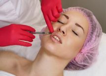 botox boom di punturine spiana rughe in italia 2
