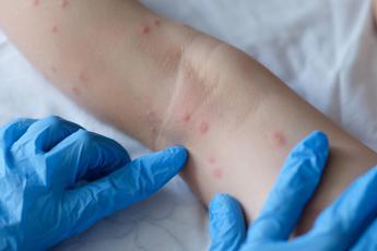 dermatologi subito task force per formare medici su ai 2