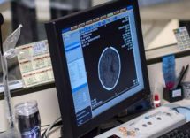 ameba mangia cervello da lavaggi nasali rischio fatale esiste 2