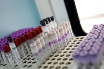 ricerca proteina sangue albumina predice rischio cancro e infarto in over 65 2