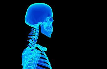 sindrome della testa che scivola sul collo come riconoscerla e trattarla 2