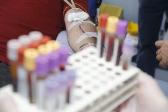 egpa lesperto diagnosi difficile ma con anti il 5 ottimi risultati 2