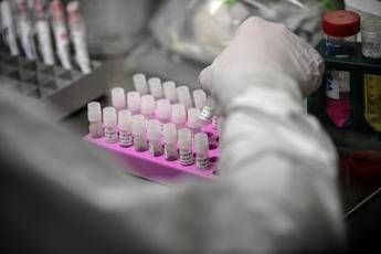rischio long covid scoperta variante genetica che lo aumenta del 60 2