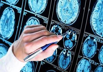 alzheimer 300mila euro a 6 scienziati per diagnosi precoce e prevenzione 4