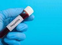 igienista triassi focoloaio epatite a punta iceberg 2