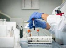 aids al croi 2025 primi dati su prep da somministrare 1 volta lanno 2