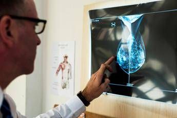 cancro al seno crioablazione nuova frontiera di cura 2