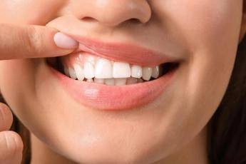 salute in 70 persone con autismo problemi a denti e gengive parodontologi in campo 2
