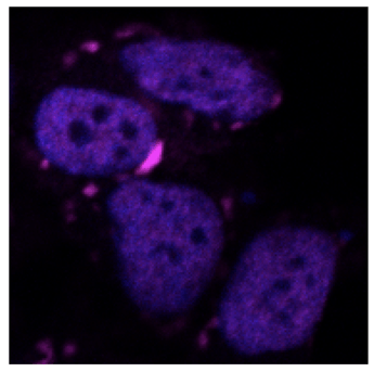 ia algoritmo iit va a caccia di proteine dannose per il cervello 2