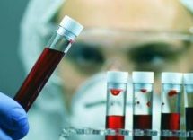 emofilia in italia nuova soluzione sottocute giornaliera per pazienti con inibitori 2