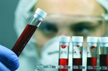 tumori ue approva terapia per adulti con leucemia linfatica cronica refrattaria 2